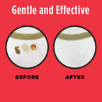 Dryel Dry-Clean Safe On-The-Go Stain Removal Pen for Clothes and Laundry, 20 ml - [size:0.7 Fl Oz (Pack of 1)]